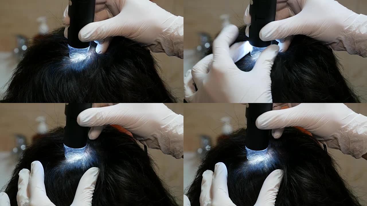 在进行中胚层疗法之前对女性头皮进行检查