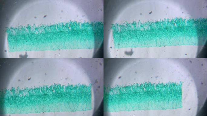显微镜下青霉菌