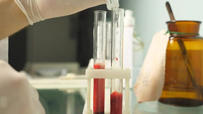测试血样。实验室男医生的手用血液在试管中添加过氧化氢。关闭慢动作侧视图