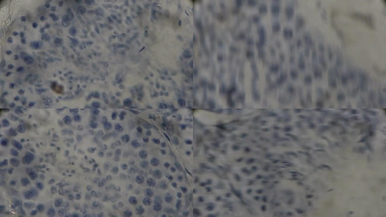 显微镜下的睾丸活检视图