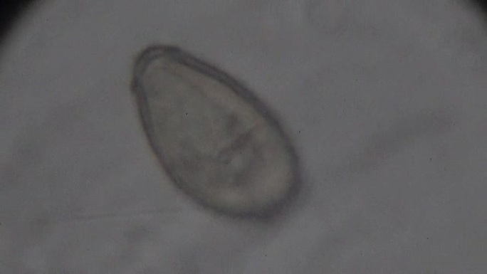 光镜下肝吸虫支睾吸虫病虫卵