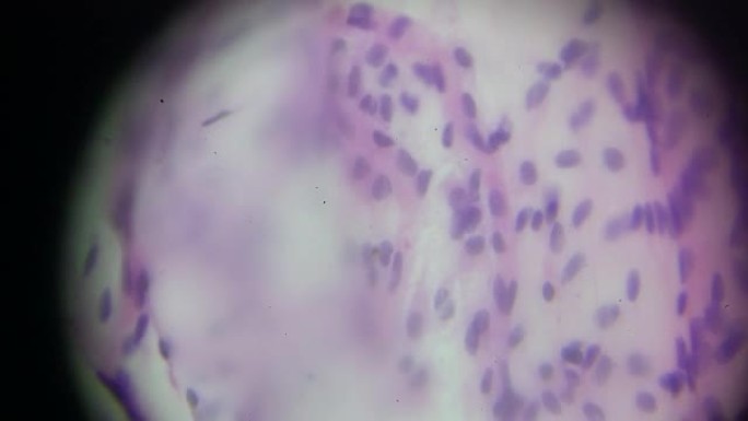 显微镜下巨噬细胞