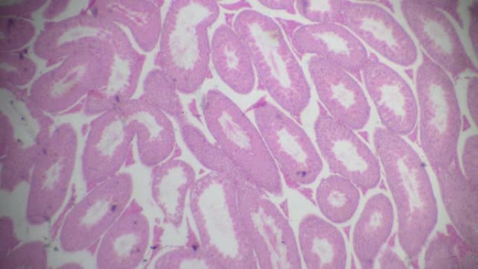 显微镜下睾丸和附睾片