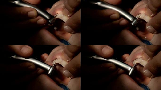 牙医治疗美丽的微笑