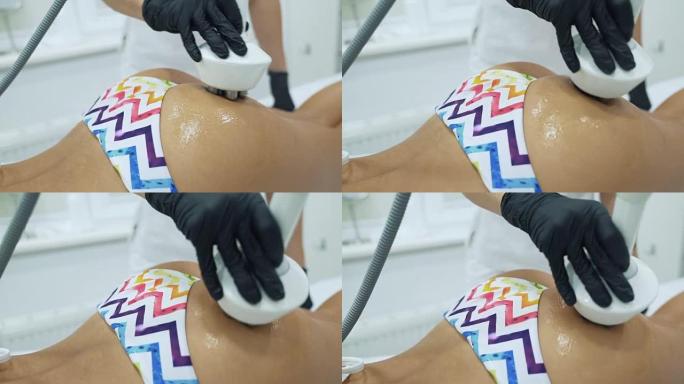 一个用射频提臀的特写。化妆师使用该装置以圆周运动按摩病人的臀部，该装置作用于皮肤、皮下淋巴并去除多余