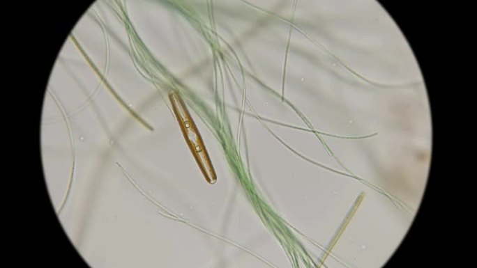 显微镜下硅藻在普通活藻中的运动