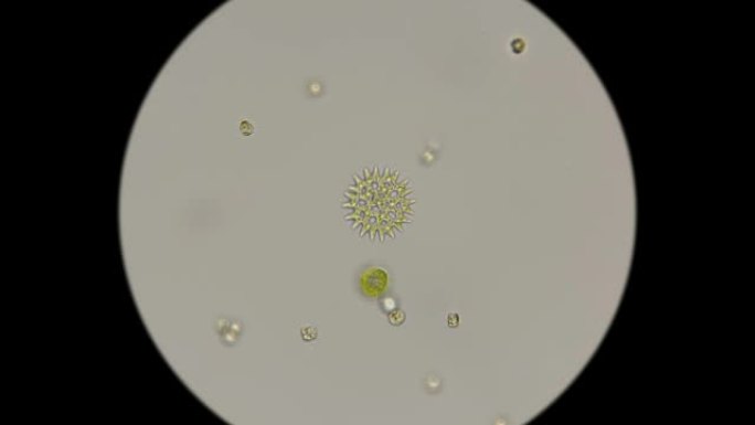显微镜下硅藻的美丽图案