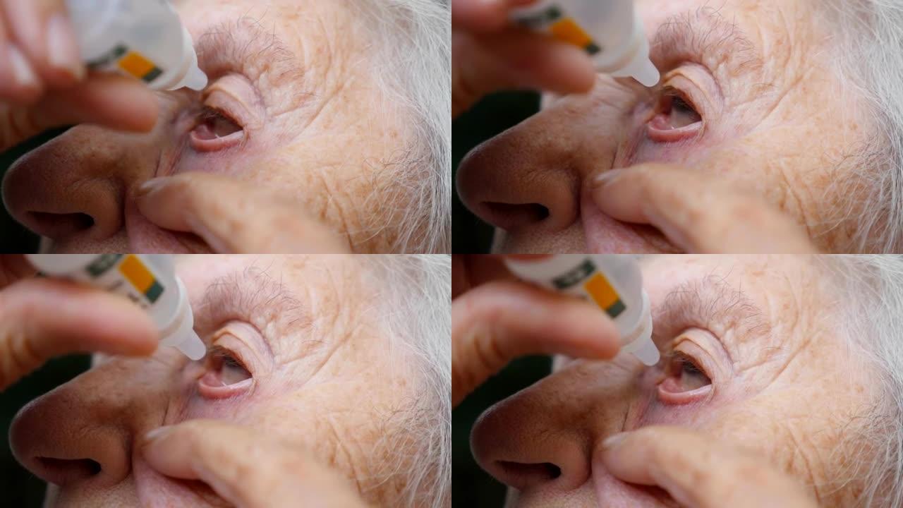 老妇人在她的眼睛里滴着医疗滴剂。祖母的肖像。医疗保健和医疗概念。关闭慢动作