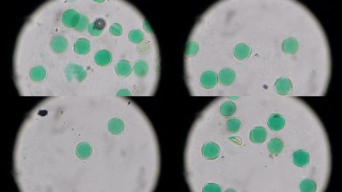 显微镜下油菜花花粉