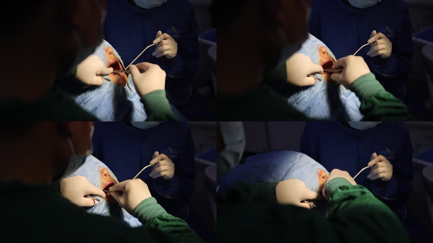 种植牙手术医生做手术种植体口腔手术50帧