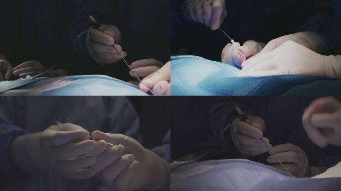 介入治疗介入手术特写