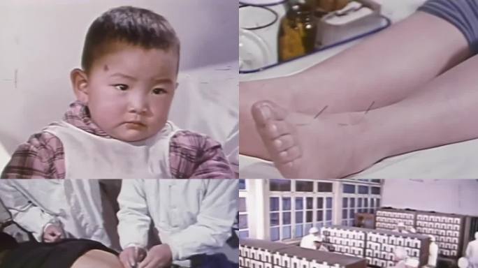 中医院 针灸治疗病人 1971年