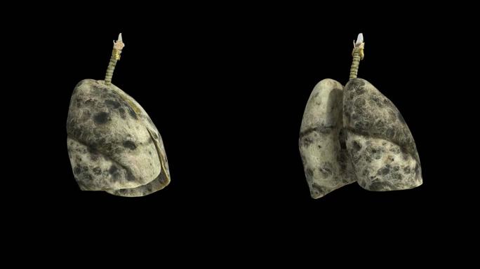 肺部病变呼吸系统医疗动画3D旋转带通道