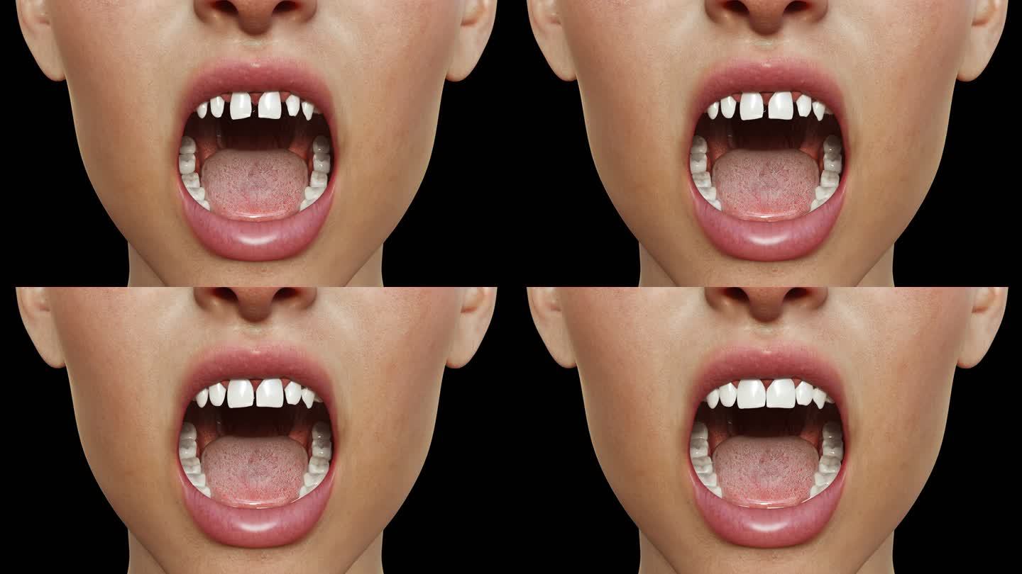 牙齿从稀疏变整齐门牙大牙再生医疗动画通道