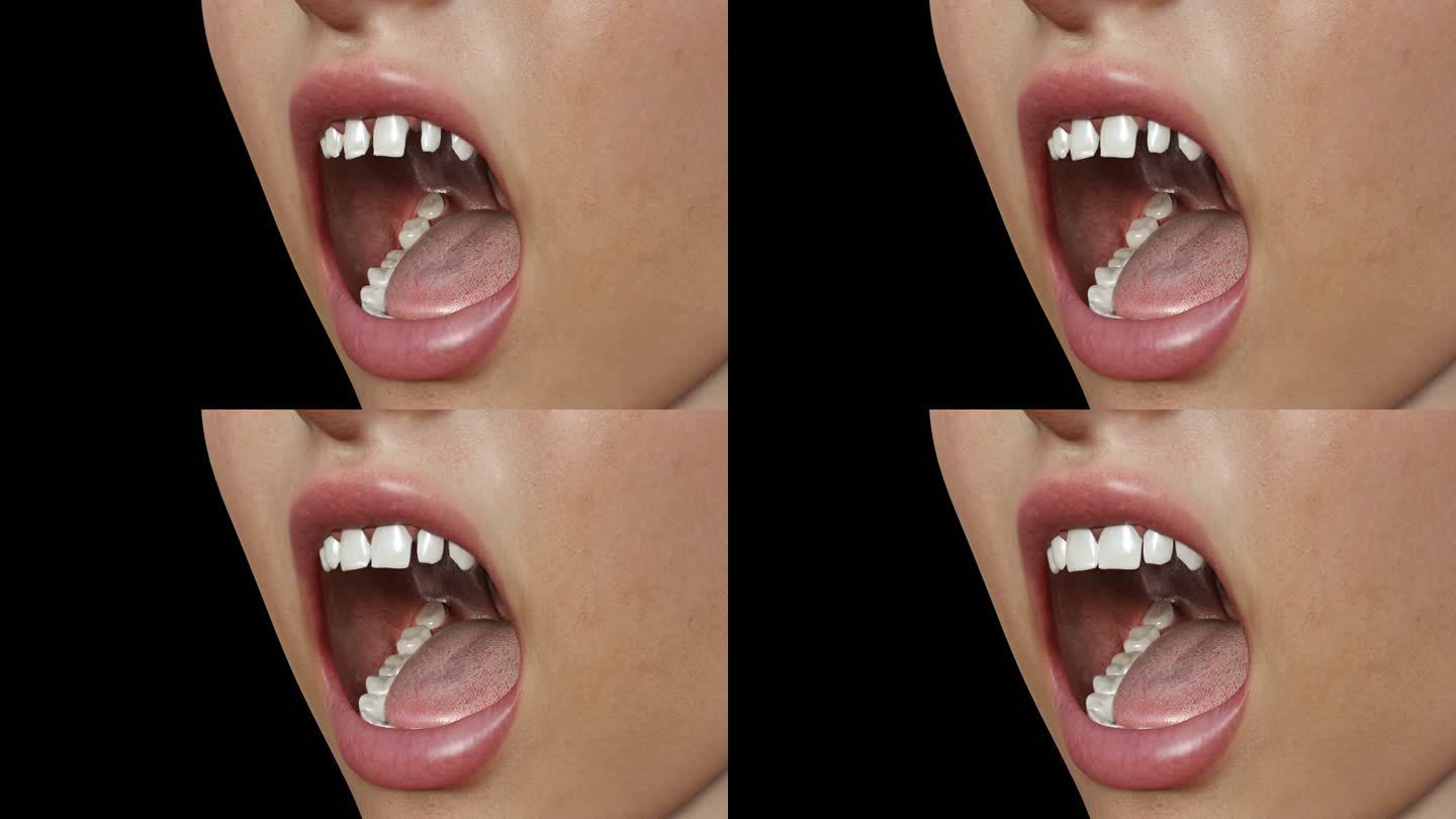 牙齿生长变整齐3D动画医疗带通道