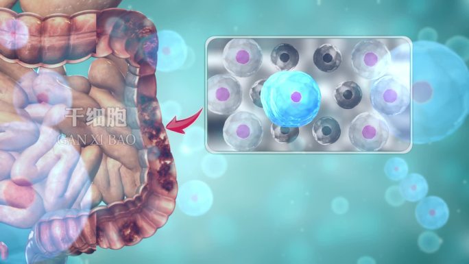 干细胞技术可以让人长出新的肠道黏膜细胞