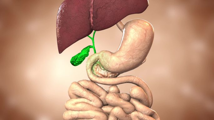 胆汁进入肠道 刺激肠道 导致十二指肠病变