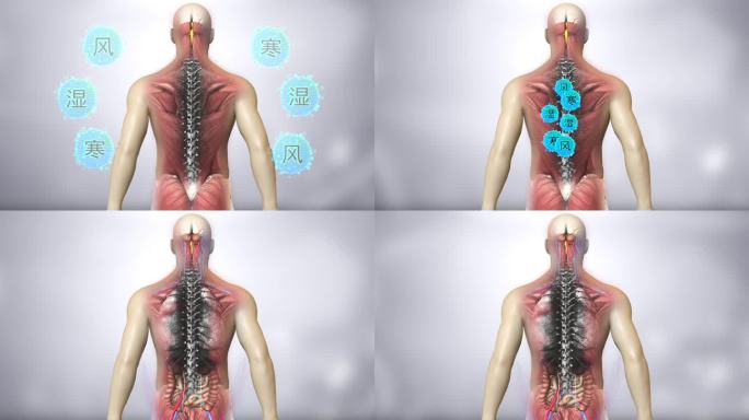 腰椎变红 代表腰椎病  放大腰椎