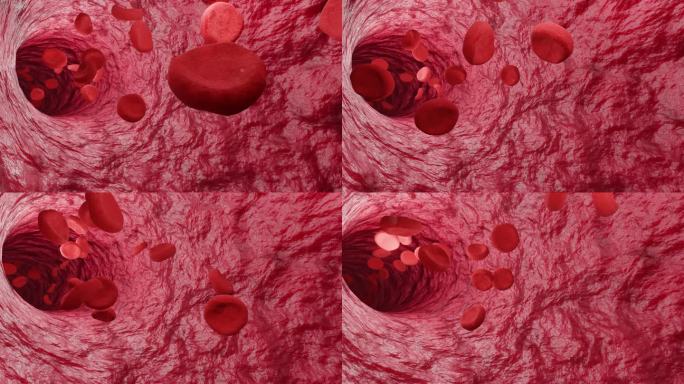 红细胞在血管内流动