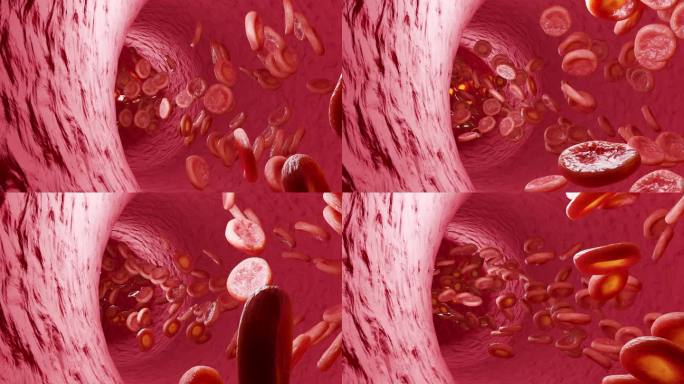 三维模拟血细胞血管流动