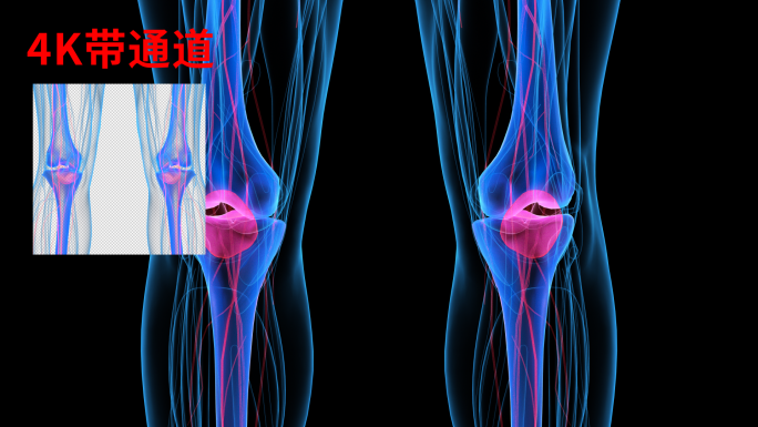4K 膝盖痛关节炎特写骨骼骨头半月板弯曲