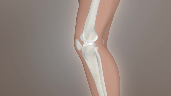 修复关节 膝关节修复