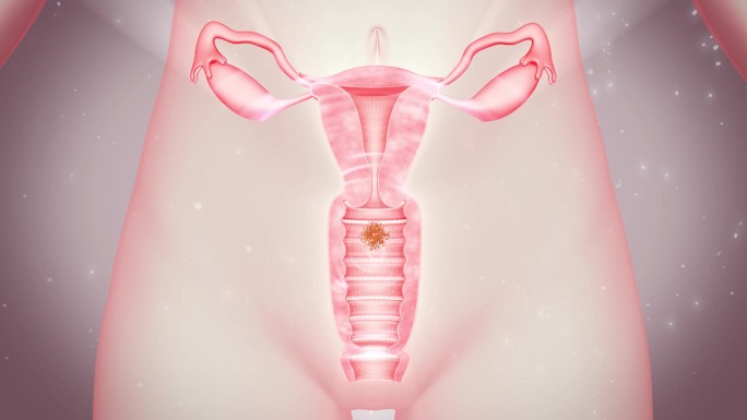 阴道病毒细菌 女性生殖系统 粘膜敏感
