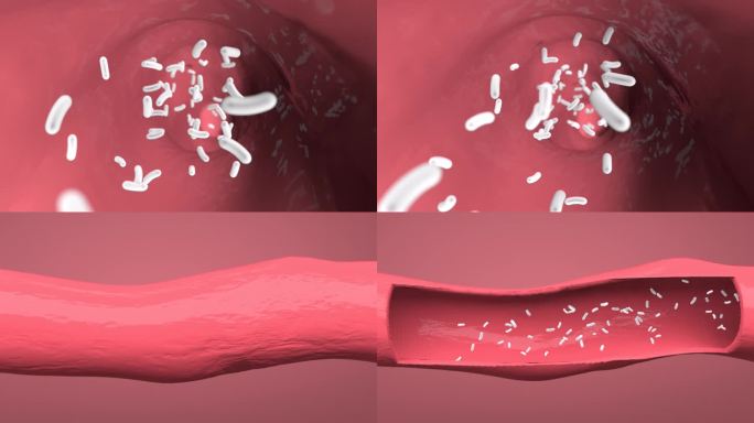 肠道蠕动消化吸收治疗血管