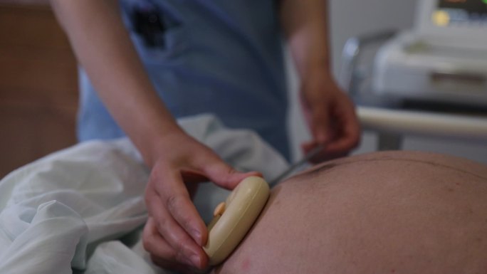孕妇胎心监护，胎心监护仪，孕妇，胎心检测