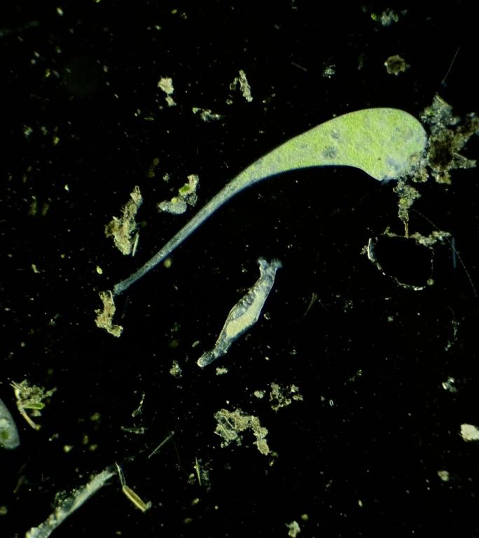 暗场显微镜放大40倍的微生物喇叭虫与轮虫