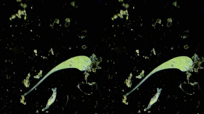 暗场显微镜放大40倍的微生物喇叭虫与轮虫