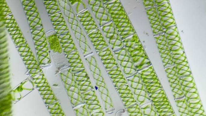 显微镜下放大100倍的藻类水绵细胞