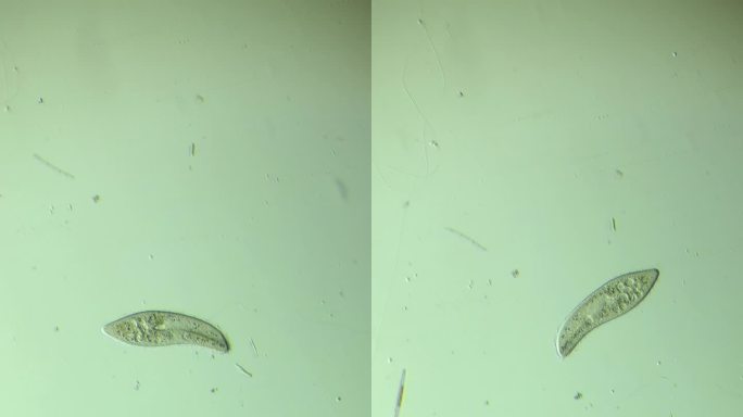 显微镜下放大100倍的微生物草履虫