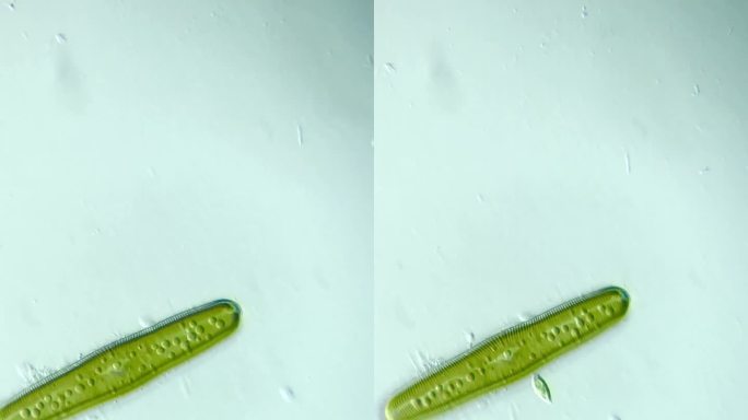 微分干涉显微镜放大400倍的微生物硅藻
