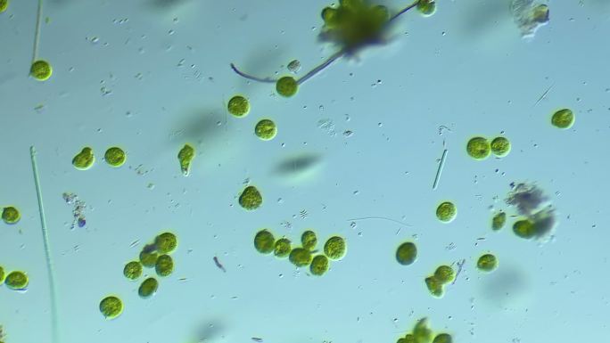 显微镜下放大100倍的微生物眼虫裸藻