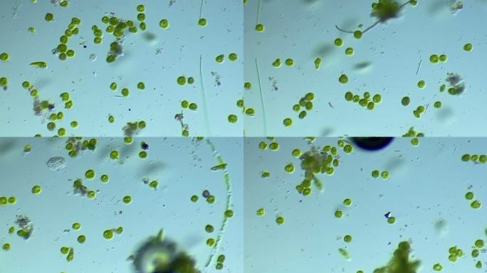 显微镜下放大100倍的微生物眼虫裸藻