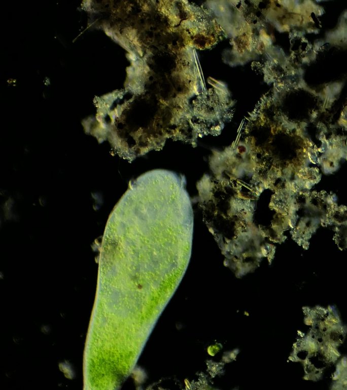 暗场显微镜放大40倍的微生物喇叭虫与轮虫