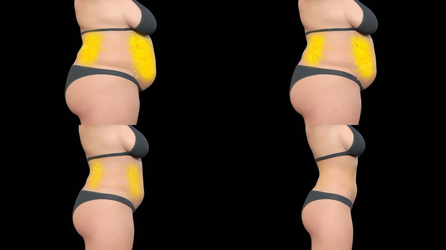 侧面女人减肥动画燃烧脂肪卡路里油脂通道