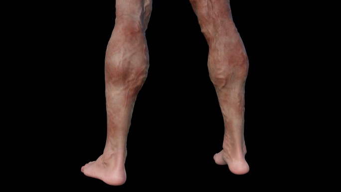 背面小腿静脉曲张恢复动画3D医疗机理血管