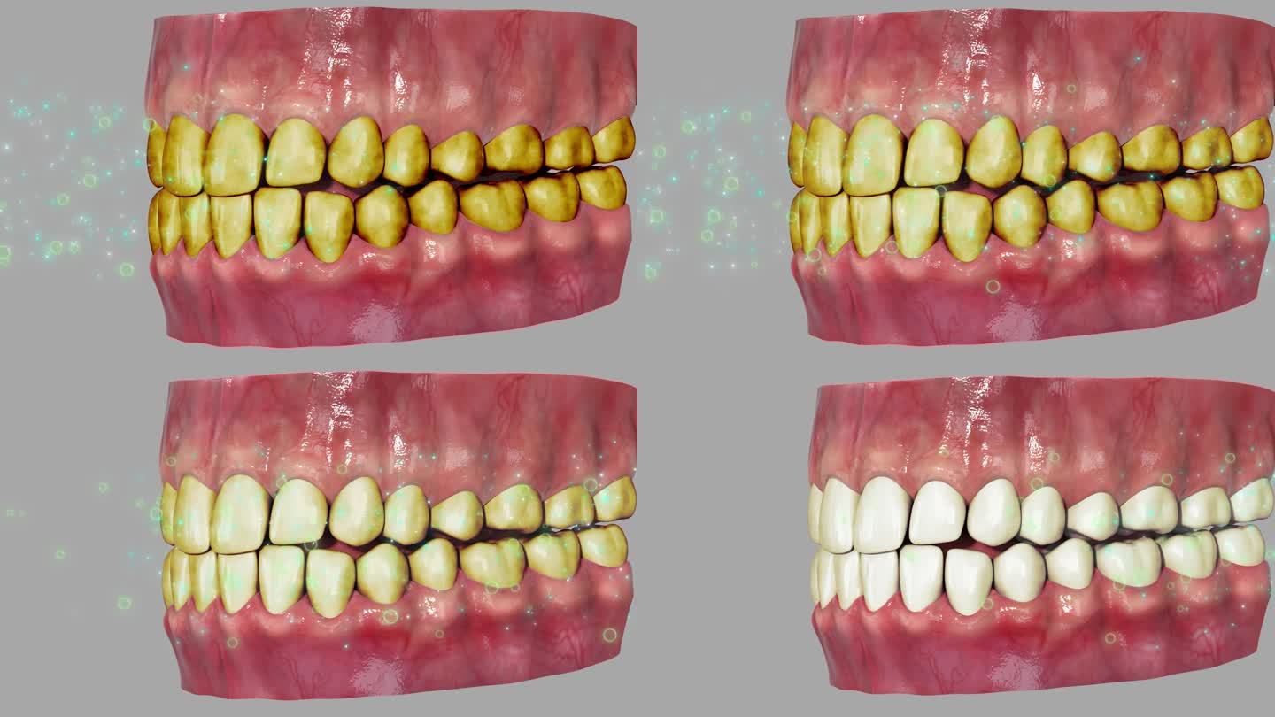 口腔清洁3D动画牙齿黄变白洁牙清新口气