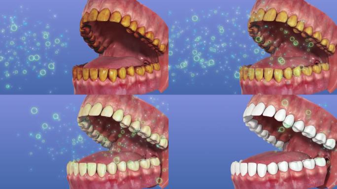 三维牙齿模型洁牙素材黄牙变白牙动画