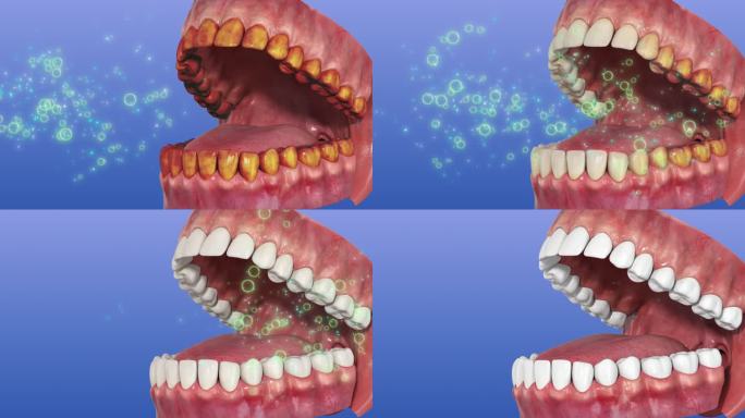 3D牙齿模型口腔清洁黑牙变白清新口气