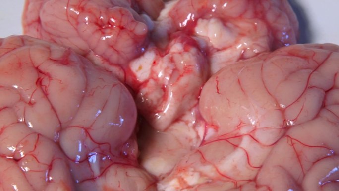 解剖 病猪脑软组织 病变部位 内部结构