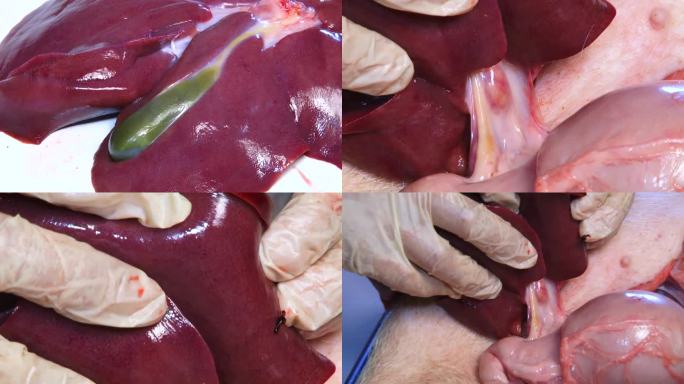 解剖 猪内脏 猪肝 猪胆 淋巴结红肿出血