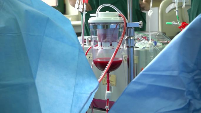 纪录片新闻-手术室仪器ECMO人工心脏