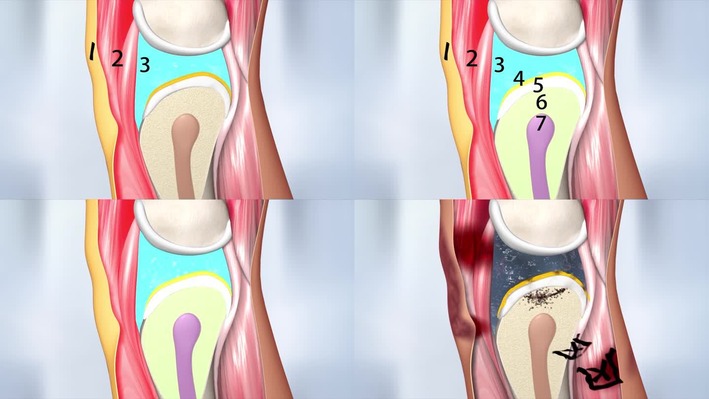 7层骨组织 人体骨骼关节 软骨修复 骨毒