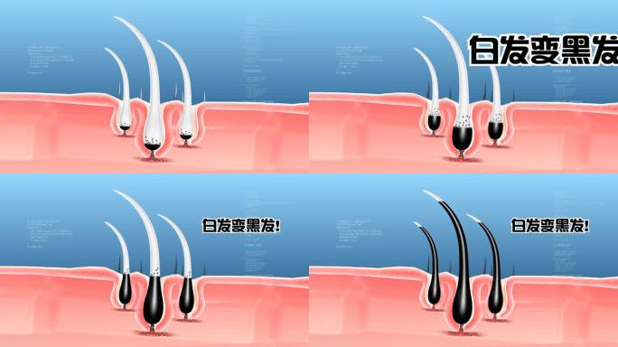 白发变黑发 修复受损发质