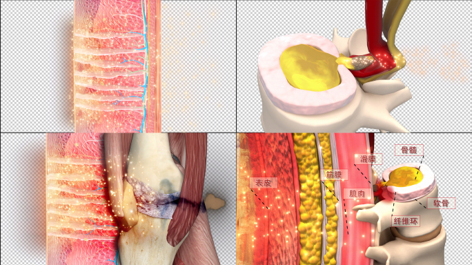 医学机理 七层透骨修复骨病[带透明通道]