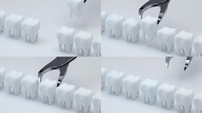 动画安装新牙，3D渲染。