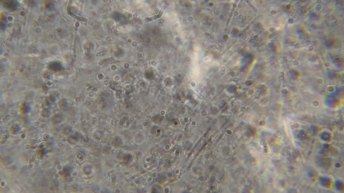 显微镜下精子运动5